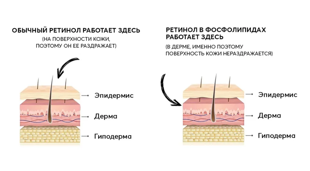 Словарь под редакцией Skinjestique: ретинол